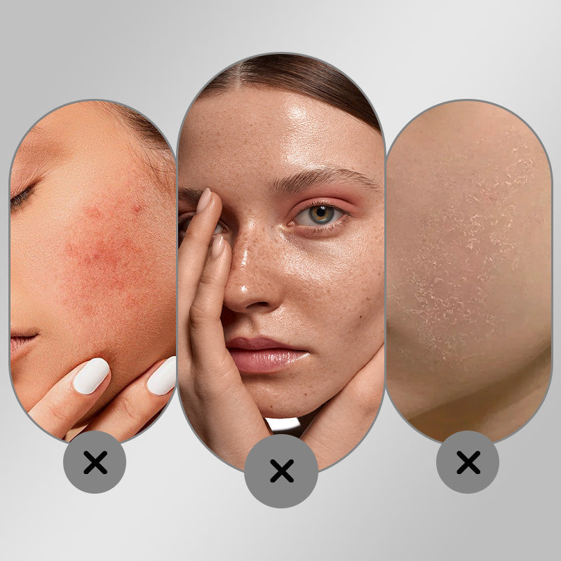 🔥Hot Sale 50% OFF🔥Bleichende und feuchtigkeitsspendende Gesichtscreme zur Beseitigung von Sommersprossen