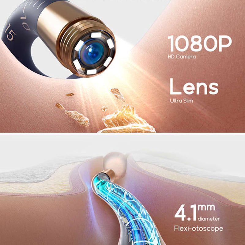 💯Du kannst beruhigt deine Ohren putzen 😍Visuell gebogenes Ohrschmalz-Entfernungsset