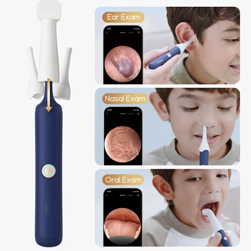 💯Du kannst beruhigt deine Ohren putzen 😍Visuell gebogenes Ohrschmalz-Entfernungsset