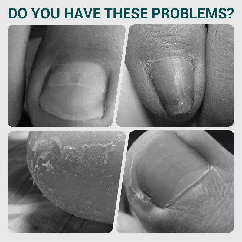 🎁Heißer Verkauf 50% Rabatt💥Abgewinkelter Profi-Nagelknipser mit Feder