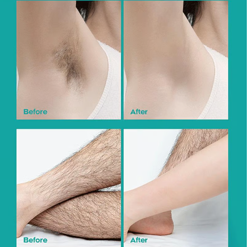 🔥 Begrenzter Verkauf - Kaufen Sie 2 und erhalten Sie 1 gratis! 🎁 Schmerzfreie Ganzkörper-Haarentfernungscreme 💧✨