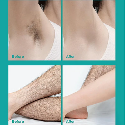 🔥 Begrenzter Verkauf - Kaufen Sie 2 und erhalten Sie 1 gratis! 🎁 Schmerzfreie Ganzkörper-Haarentfernungscreme 💧✨