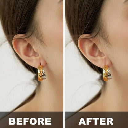 🔥50% OFF🔥10PCS Clear Earring Support Patches